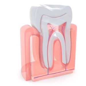 When should you choose a root canal over extraction