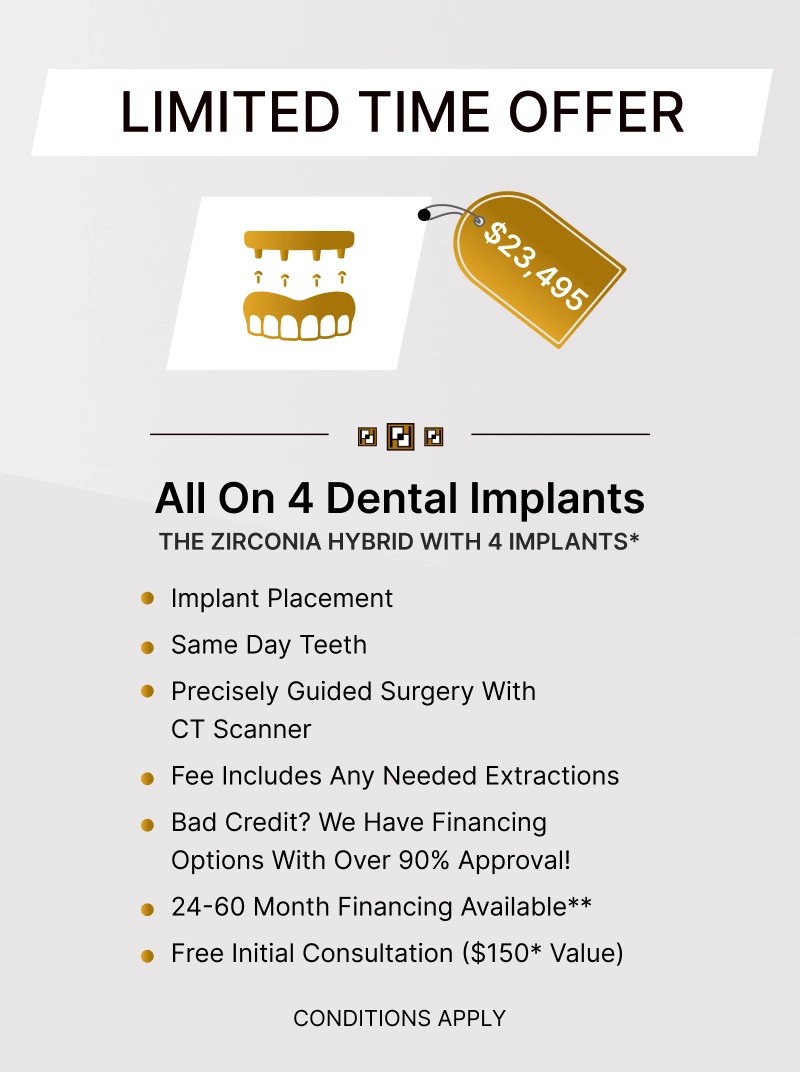 All on 4 Dental Implants (2)