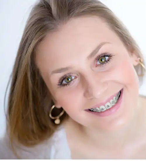 Dental Braces In Kissimmee, FL