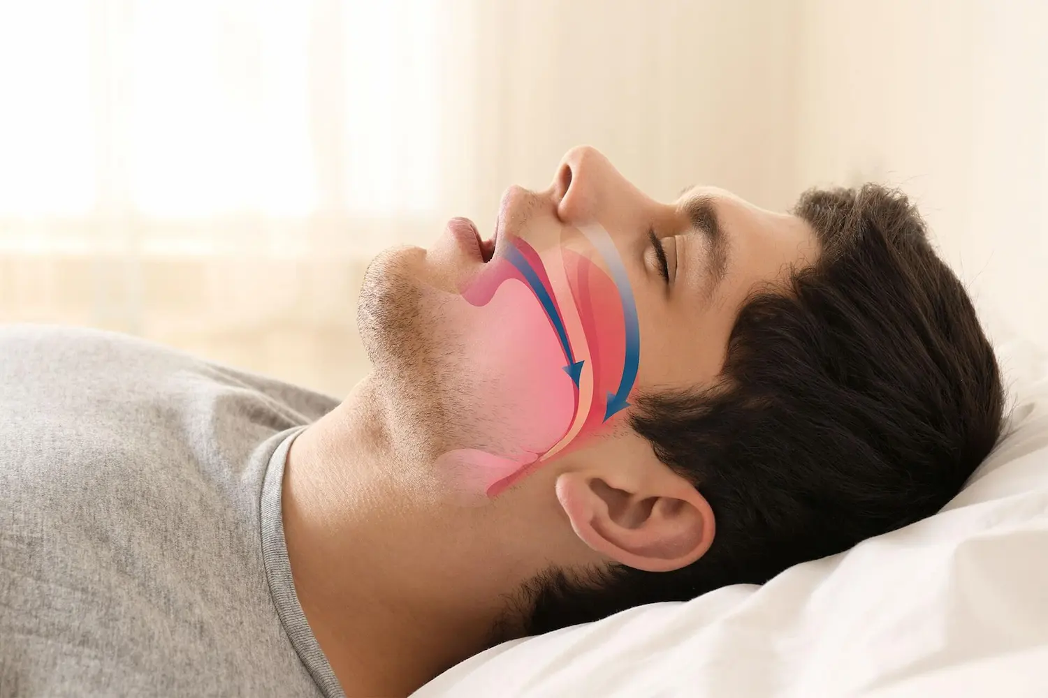QuietNite® Laser Treatment banner
